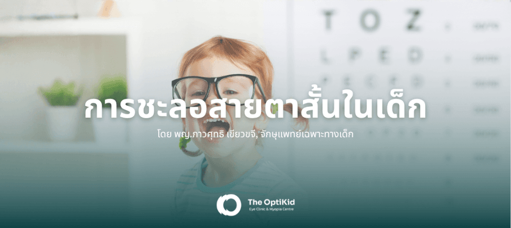 บทความเรื่อง การชะลอสายตาสั้นในเด็ก โดยจักษุแพทย์เด็กผู้เชี่ยวชาญ